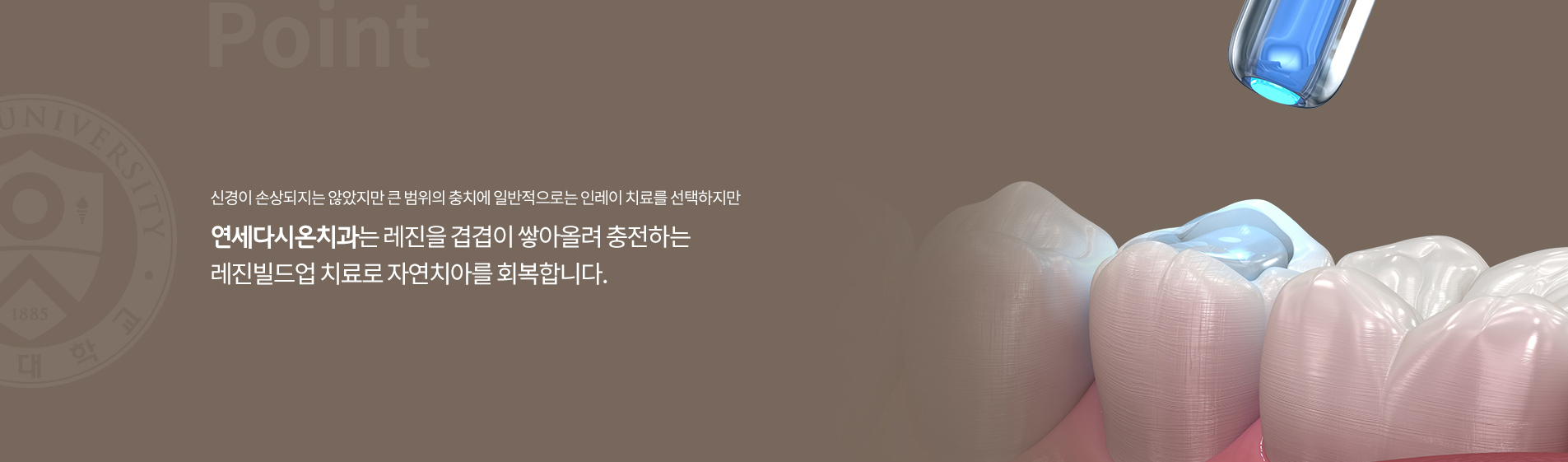 재발성 충치 및 2차 우식 가능성