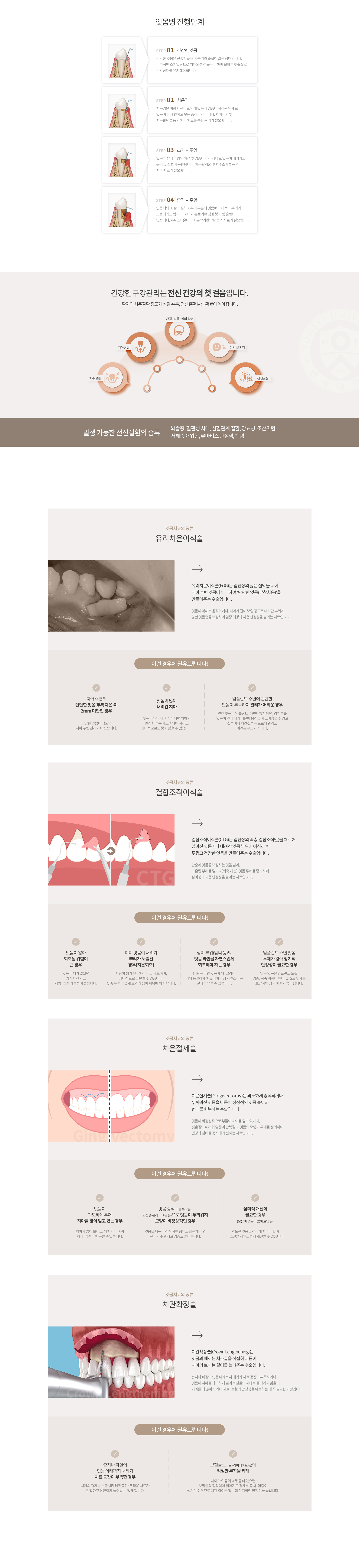 프리미엄 잇몸치료 장점 및 안내