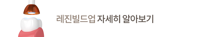레진빌드업 자세히 알아보기